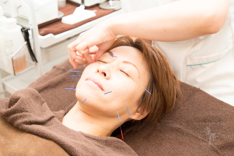 美容鍼でターンオーバー（肌の生まれ変わり）を整えて紫外線対策